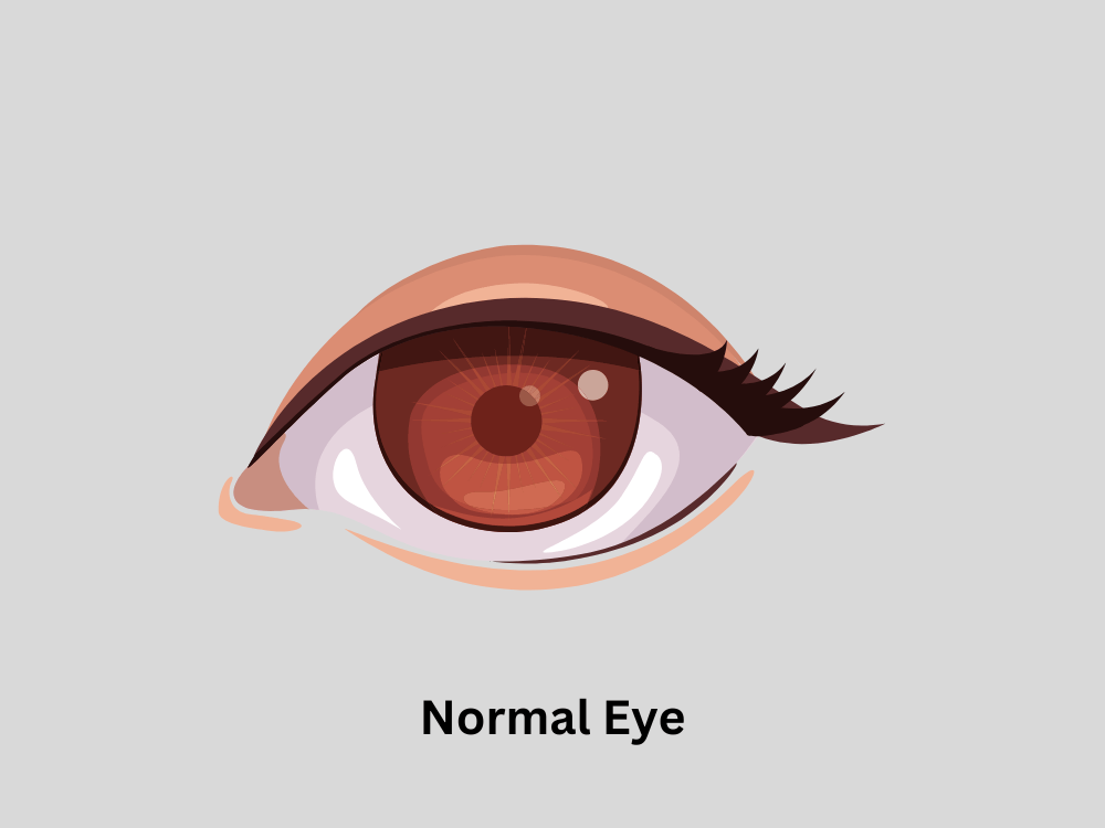 a normal eye